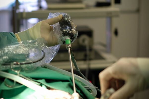 Sterilizzazione laparoscopica